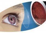 Жёсткие линзы для коррекции детского зрения